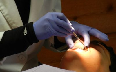 Szájpadlásfájdalom: a sebtől a gyulladásig