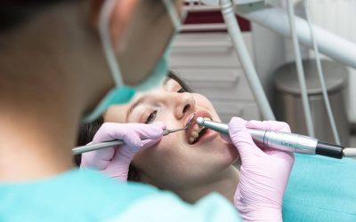 Fogfehérítés: otthon vagy rendelőben?