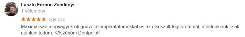 Fogimplantátum vélemények egyike