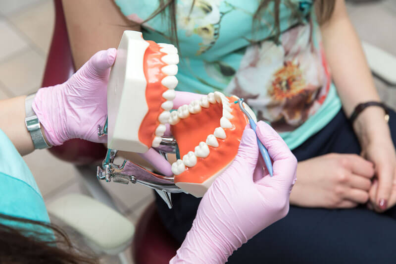 Ínyplasztika: a fogíny visszahúzódás és az ínymosoly ellenszere