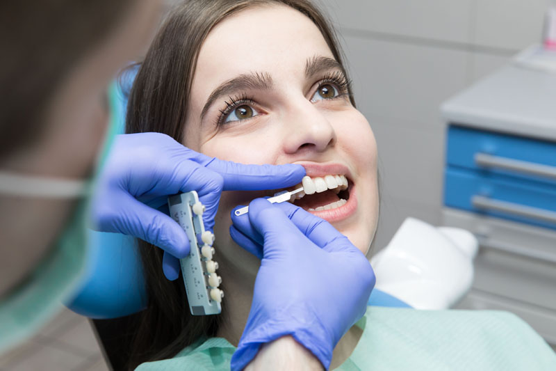 Ha törött fog helyreállítása élpótlással történik, nagyon fontos a megfelelő szín.