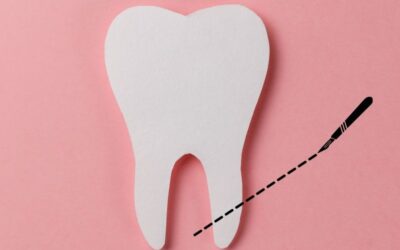 Gyökércsúcs rezekció: egy utolsó esély a gyökérkezeléssel nem gyógyítható fog megmentésére