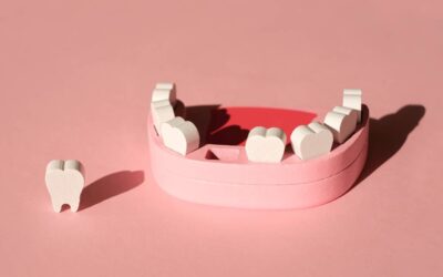 Csírahiány: mi a teendő, ha a maradó fog nem nőtt ki?