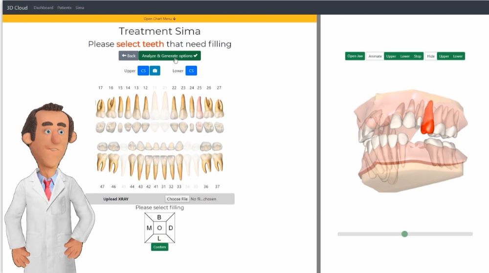 A Dentalmaster segítségével látványos egyénre szabott terv készíthető a páciensnek