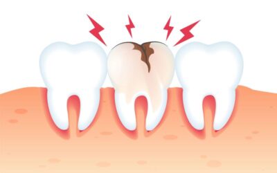 A lyukas fog kialakulása, tünetei, kezelése és megelőzése