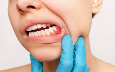 A fogíny duzzanat okai és kezelése