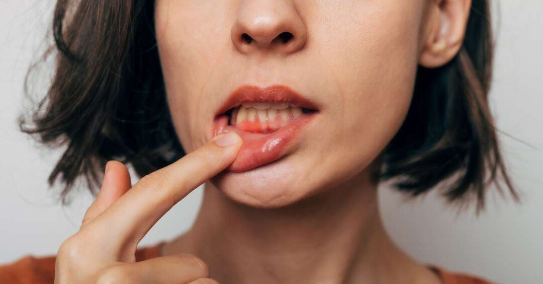 Fognyaki tömés: mikor szükséges és mi a menete?