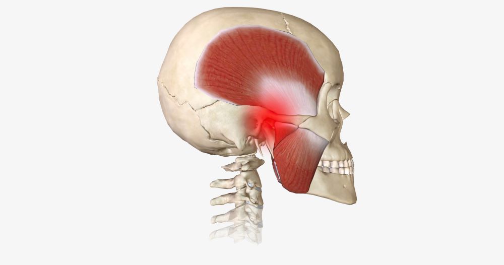 A fogcsikorgatás ellen számos módszer létezik, például a fogcsikorgatás elleni sín.