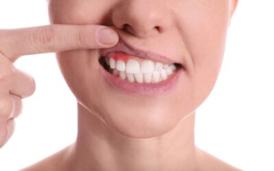 Terhességi ínygyulladás: milyen következményei lehetnek?